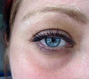 how to get rid of dark circles under eyes