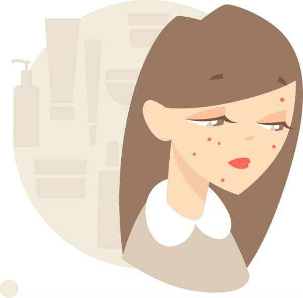 illustration for home remedies for acne