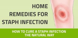 natural remedies for staph infection