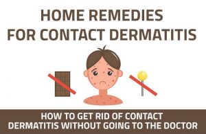 contact dermatitis remedies